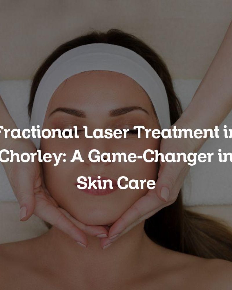 Fractional Laser Treatment in Chorley: A Game-Changer in Skin Care