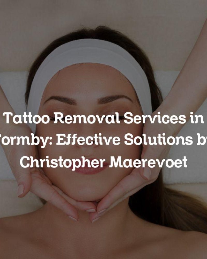Tattoo Removal Services in Formby: Effective Solutions by Christopher Maerevoet
