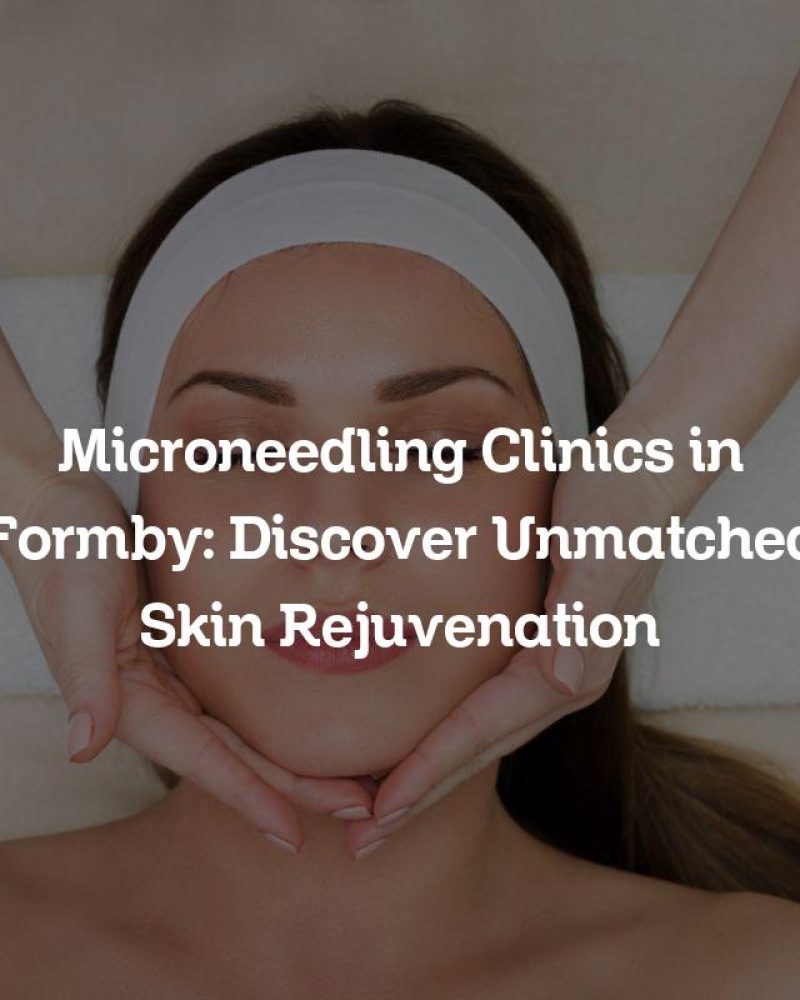 Microneedling Clinics in Formby: Discover Unmatched Skin Rejuvenation