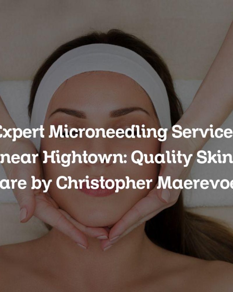 Expert Microneedling Services near Hightown: Quality Skin Care by Christopher Maerevoet