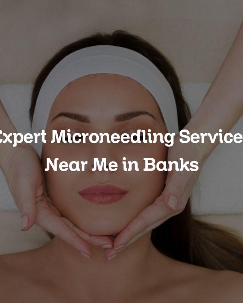 Expert Microneedling Services Near Me in Banks