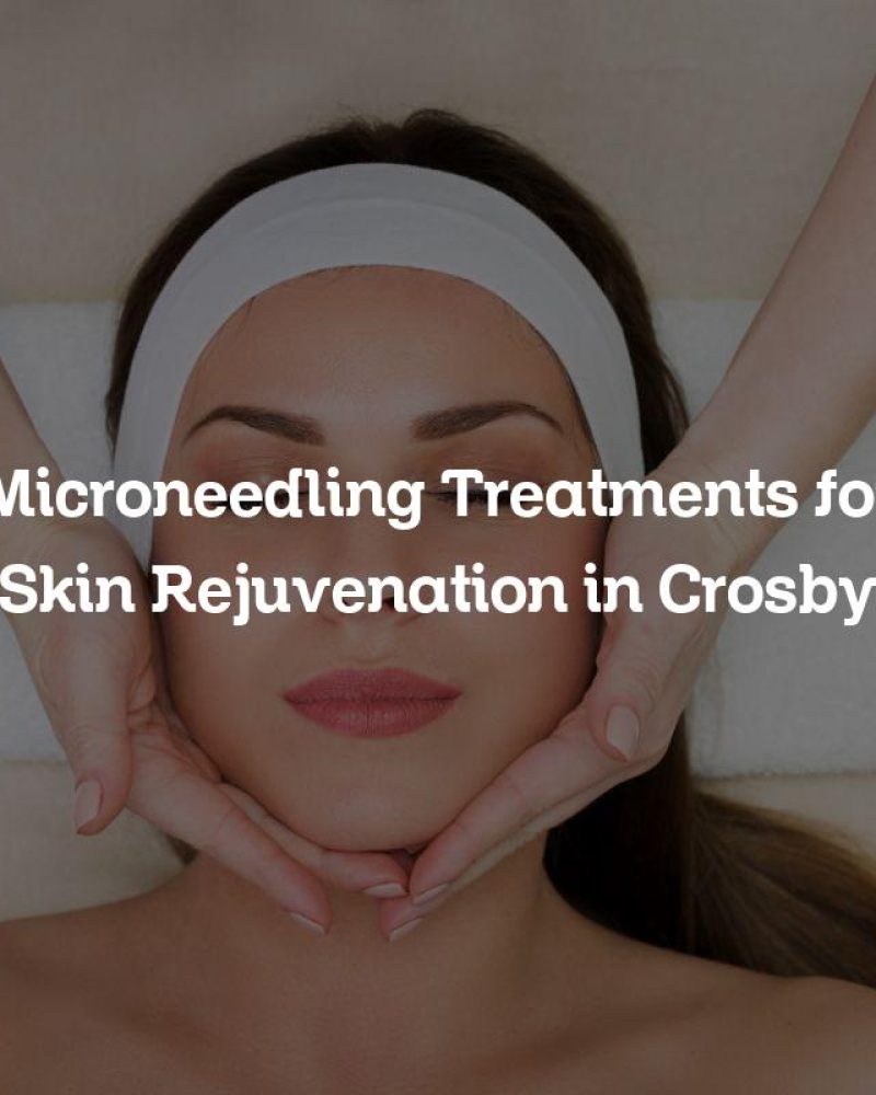 Microneedling Treatments for Skin Rejuvenation in Crosby
