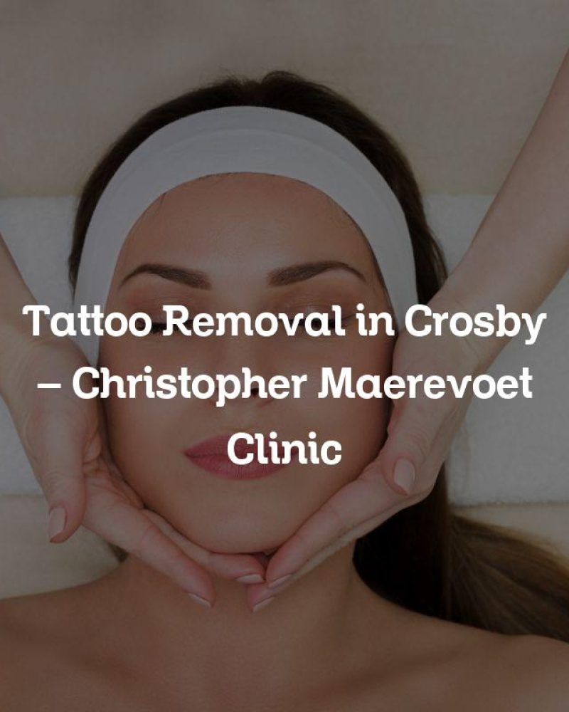 Tattoo Removal in Crosby – Christopher Maerevoet Clinic