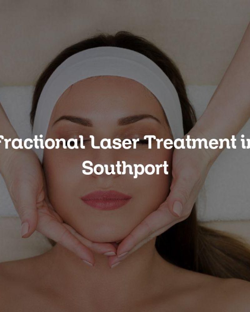 Fractional Laser Treatment in Southport