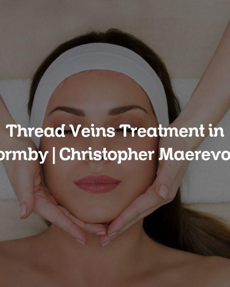 Thread Veins Treatment in Formby | Christopher Maerevoet Thread Veins Treatment in Formby | Christopher Maerevoet