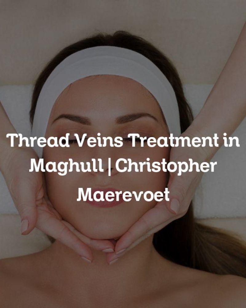 Thread Veins Treatment in Maghull | Christopher Maerevoet Thread Veins Treatment in Maghull | Christopher Maerevoet