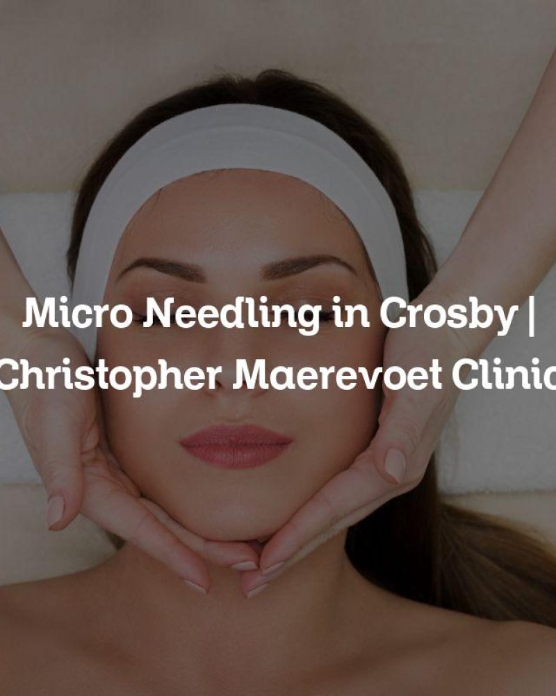 Micro Needling in Crosby | Christopher Maerevoet Clinic