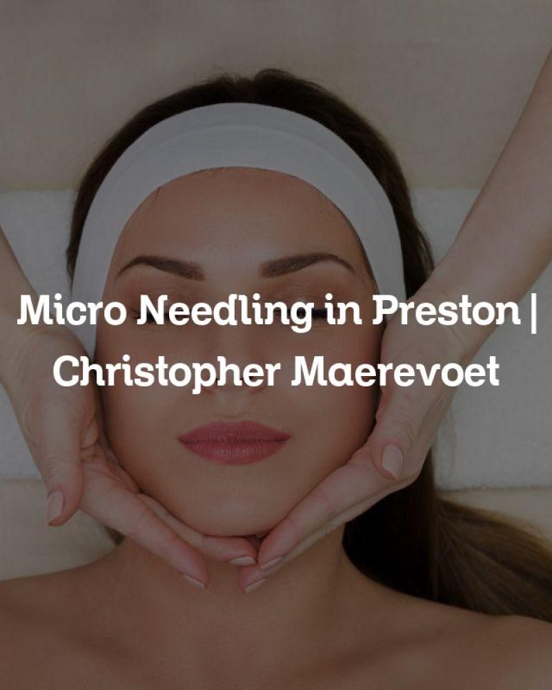 Micro Needling in Preston | Christopher Maerevoet