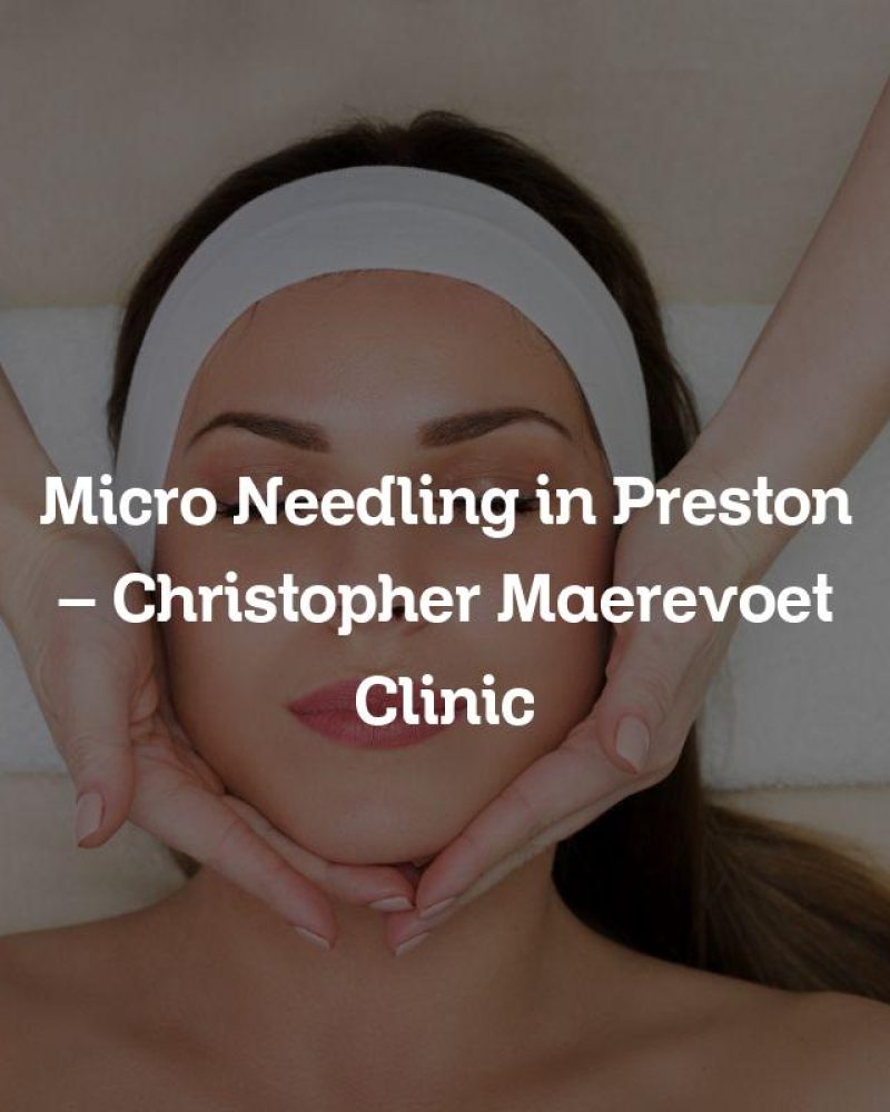 Micro Needling in Preston – Christopher Maerevoet Clinic Micro Needling in Preston – Christopher Maerevoet Clinic