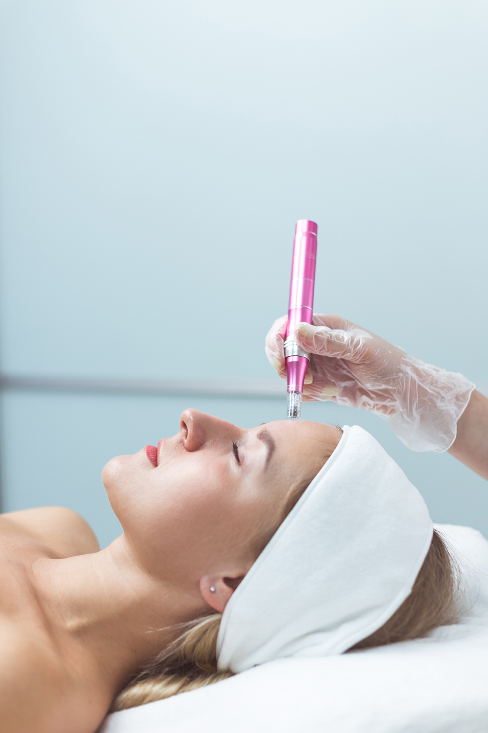 Microneedling Southport
